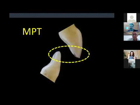 Mudança de postura terapêutica - Video aula V